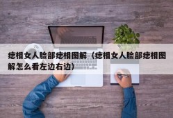 痣相女人脸部痣相图解（痣相女人脸部痣相图解怎么看左边右边）