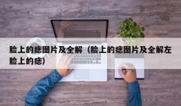 脸上的痣图片及全解（脸上的痣图片及全解左脸上的痣）